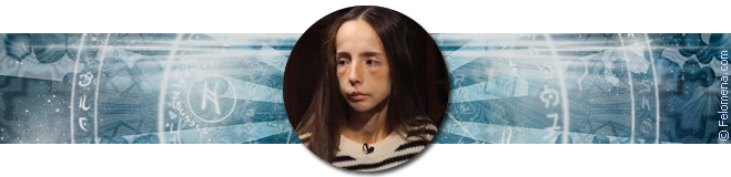 Помочь больной анорексией